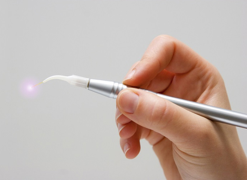 Photo of a hand holding a dental tool