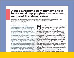 4-18-22_GenDen 4-18-22_GenDen