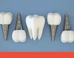 7-25-22_Marketing Implants 7-25-22_Marketing Implants